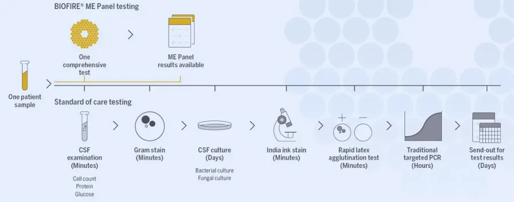 روند تشخیص مولکولی مننژیت