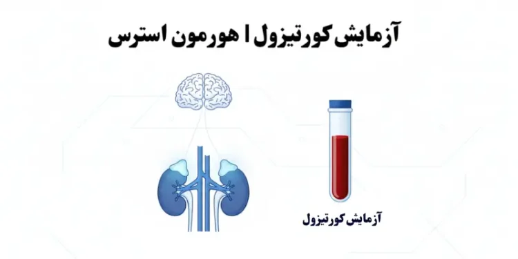 آزمایش کورتیزول